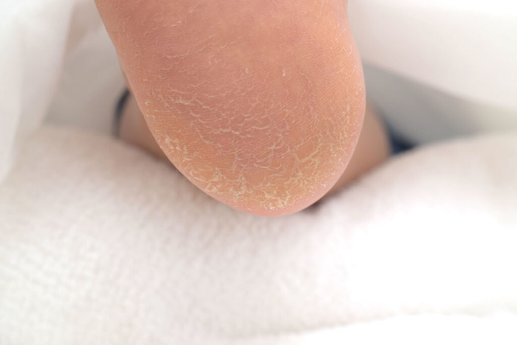 冬のかかと（クリスマスプレゼントにもおすすめ）